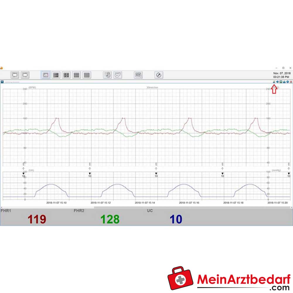 Medical Econet Smart 3 Zwillings-Fetalmonitor.