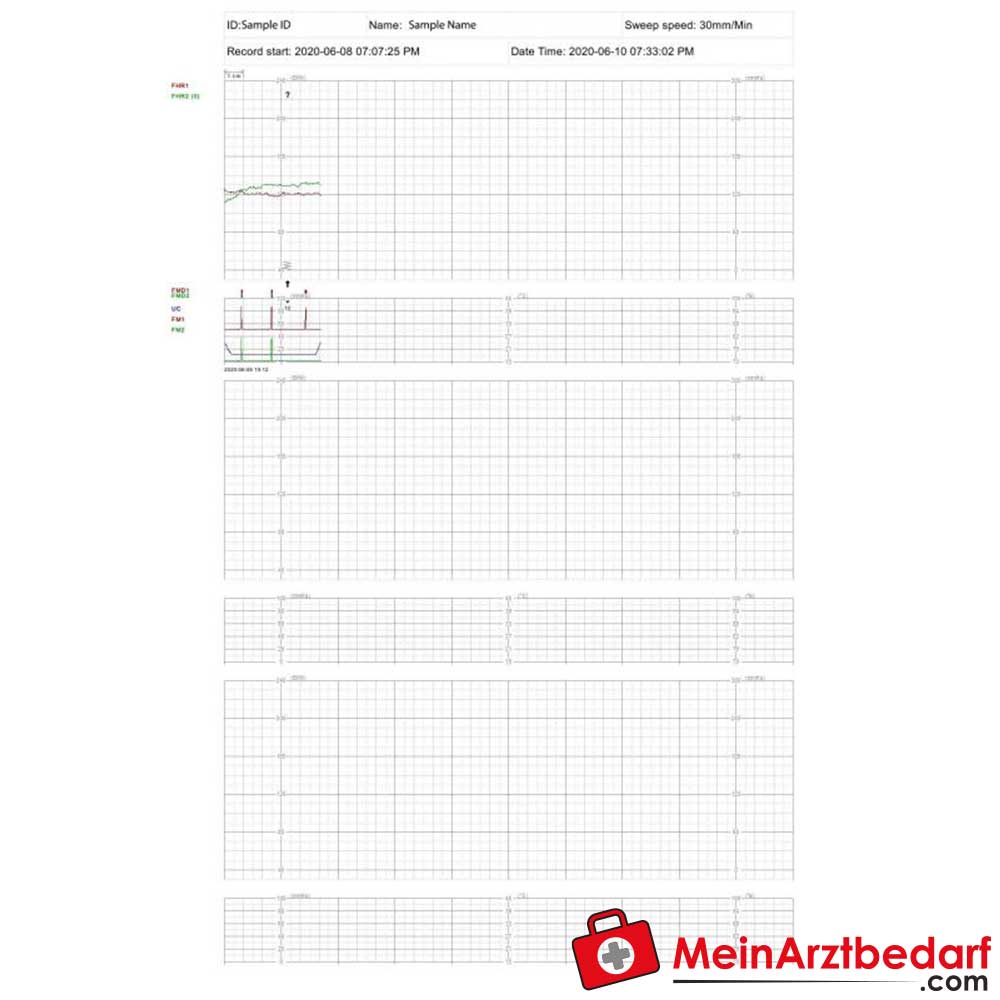 Medical Econet Smart 3 Zwillings-Fetalmonitor.