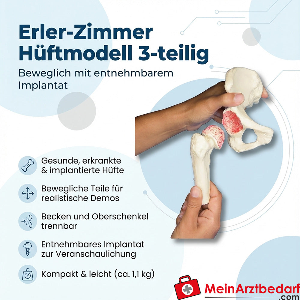 Modèle de hanche Erler Zimmer en 3 parties, mobile avec implant amovible et statif en plexiglas