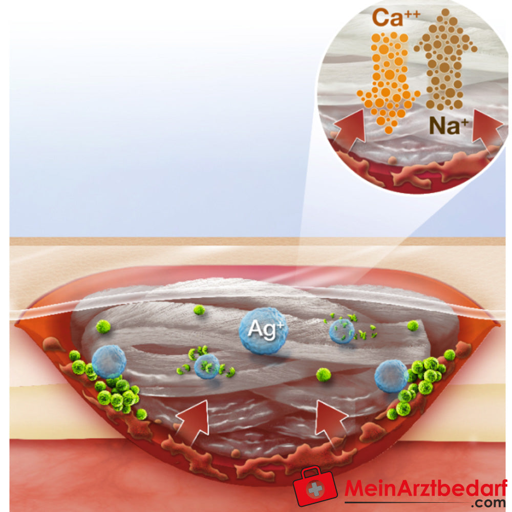 Suprasorb A+AG Pro Antimikrobieller Calciumalginat-Verband.