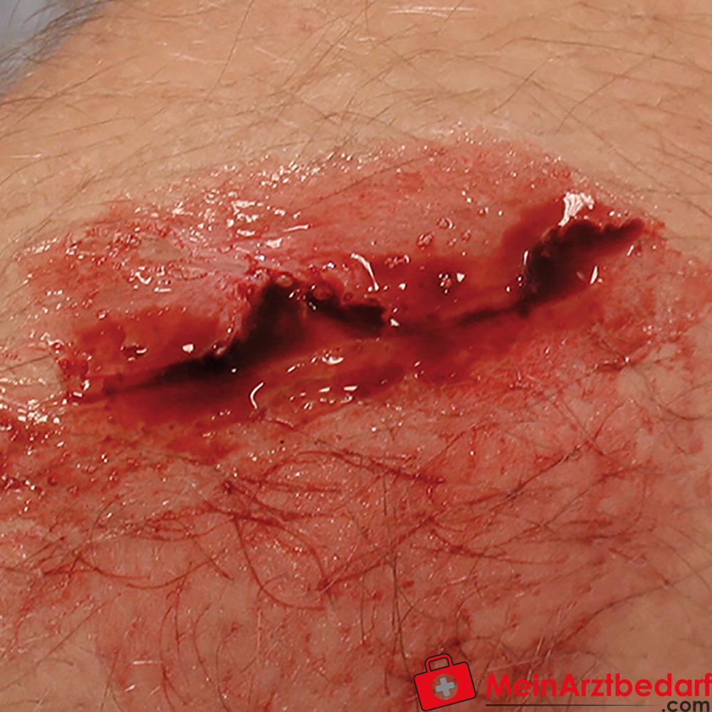 Erler-Zimmer EZ Wounds Wundensimulationsset „Professional“.