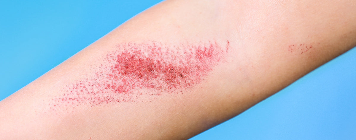 wundversorgung