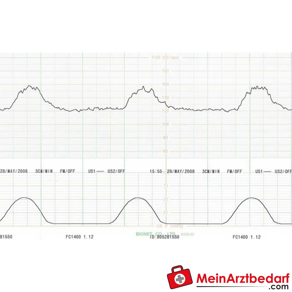 Medical Econet Smart 3 Zwillings-Fetalmonitor.