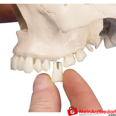 Erler-Zimmer Dental-Schädel, 4-teilig.