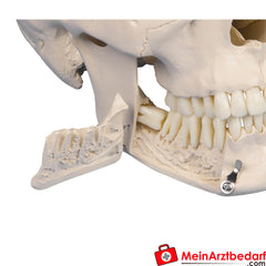 Erler-Zimmer Dental-Schädel, 4-teilig.
