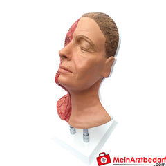 Erler-Zimmer Kopf für Gesichtsinjektionen mit Muskeln, Arterien und Nerven.