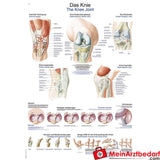 Erler-Zimmer Lehrtafel "Das Knie".