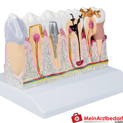 Erler-Zimmer Dentalmodell, 4-fache Größe - EZ Augmented Anatomy.