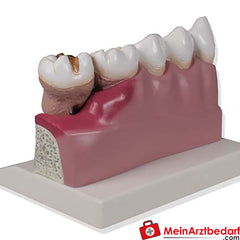 Erler-Zimmer Dentalmodell, 4-fache Größe - EZ Augmented Anatomy.